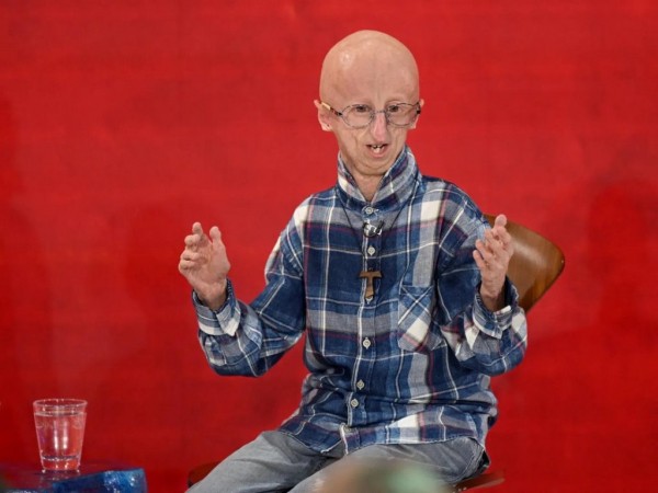 Умер самый долгоживущий человек с синдромом преждевременного старения &mdash; ему было 28 лет