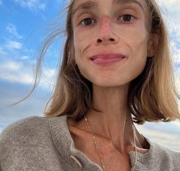 Умерла девушка, питавшаяся только фруктами &mdash; она весила чуть больше 20 кг