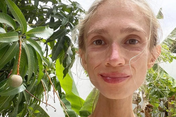 Умерла девушка, питавшаяся только фруктами &mdash; она весила чуть больше 20 кг